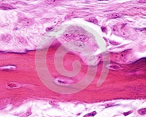 Osteoclast. HowshipÃ¢â¬â¢s lacuna